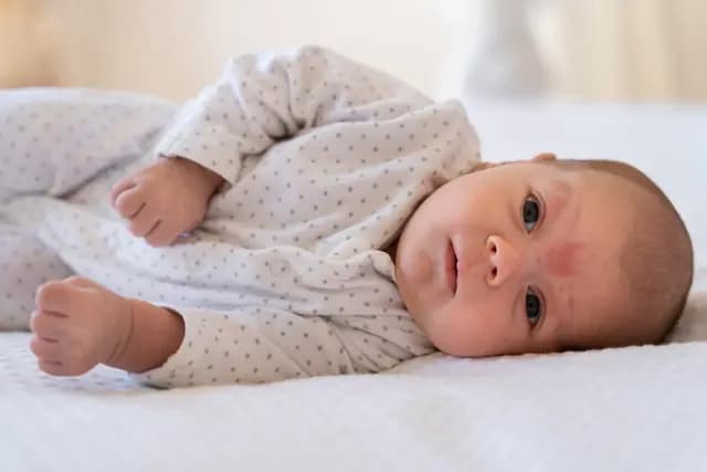 Ruam di Lipatan Leher Bayi? 3 Area yang Wajib Dibersihkan Setelah Menyusui